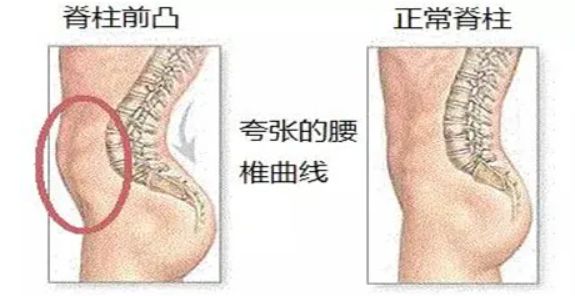 运动康复的意义_康复运动的目的_康复运动的重要性