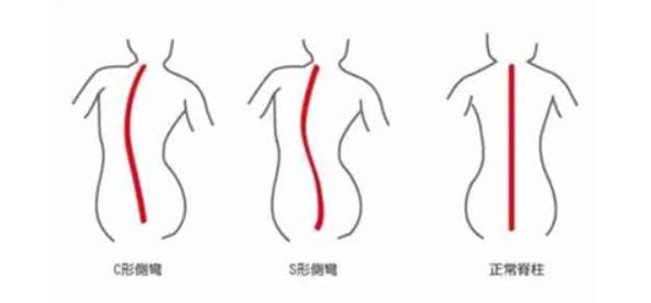 康复运动的重要性_康复运动的目的_运动康复的意义