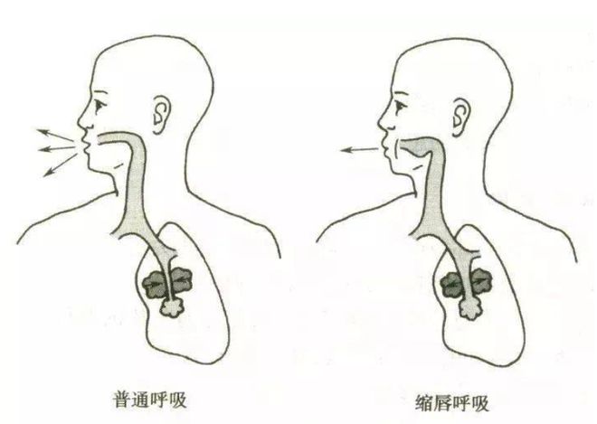 运动康复的意义_康复运动的重要性_康复运动的目的